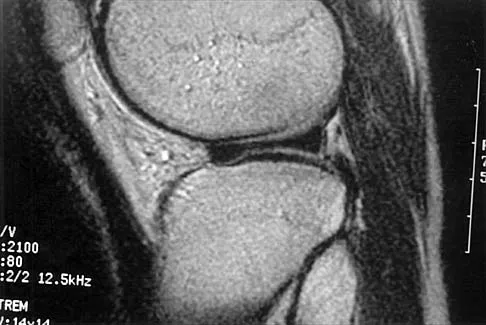 Anatomy 2026 MCQs: Board Review Questions & Answers (Part 1) - Figure 57