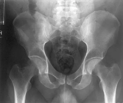 Anatomy 2026 MCQs: Board Review Questions & Answers (Part 1) - Figure 71