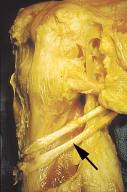 Anatomy 2026 MCQs: Board Review Questions & Answers (Part 1) - Figure 79