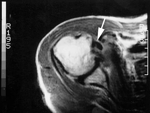 Anatomy 2026 MCQs: Board Review Questions & Answers (Part 2) - Figure 65