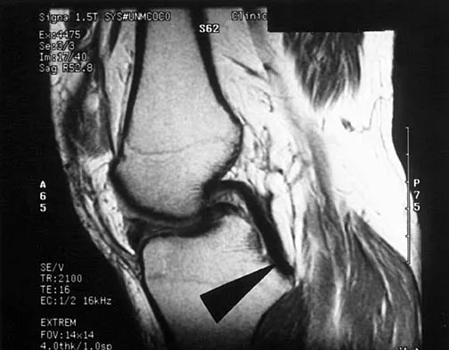 Anatomy 2026 MCQs: Board Review Questions & Answers (Part 2) - Figure 77