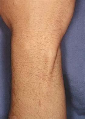 Orthopedic Anatomy 2026 MCQs (Part 3): Spine & Pelvic Girdle | AAOS & ABOS Review