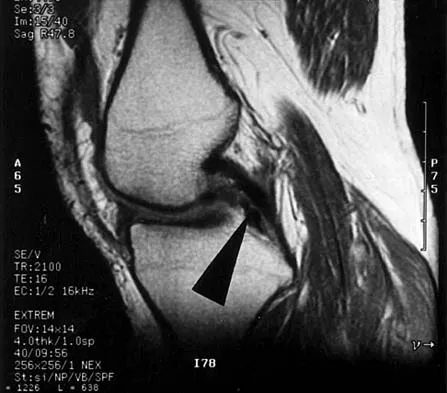 Anatomy 2026 MCQs: Board Review Questions & Answers (Part 3) - Figure 5