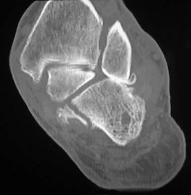 Anatomy 2026 MCQs: Board Review Questions & Answers (Part 3) - Figure 65