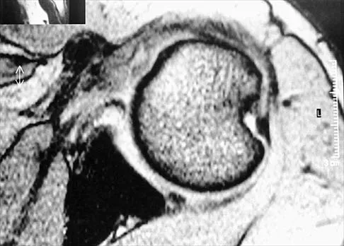 Anatomy 2026 MCQs: Board Review Questions & Answers (Part 4) - Figure 17