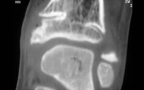 Anatomy 2026 MCQs: Board Review Questions & Answers (Part 4) - Figure 39