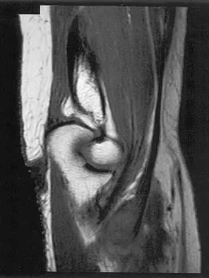 Anatomy 2026 MCQs: Board Review Questions & Answers (Part 4) - Figure 47