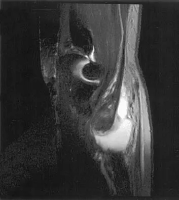 Anatomy 2026 MCQs: Board Review Questions & Answers (Part 4) - Figure 49