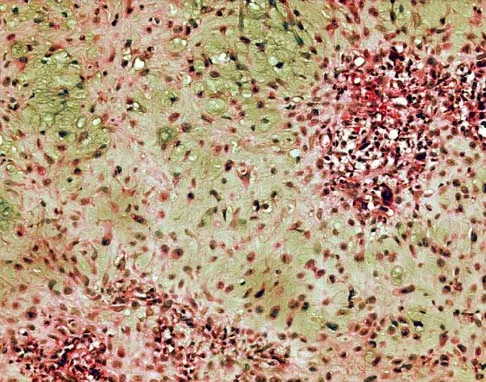 Basic Science 2000 Practice Questions: Set 1 (Solved) - Figure 21