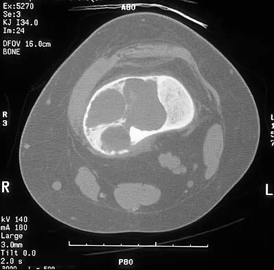 Basic Science 2000 Practice Questions: Set 1 (Solved) - Figure 36
