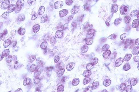 Basic Science 2000 Practice Questions: Set 1 (Solved) - Figure 4