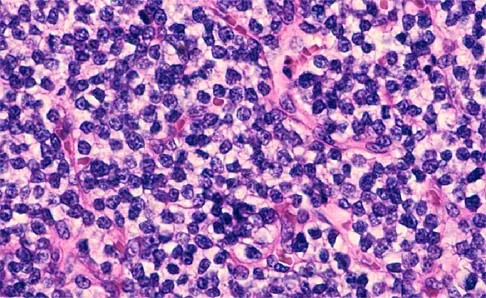 Basic Science 2000 Practice Questions: Set 1 (Solved) - Figure 9