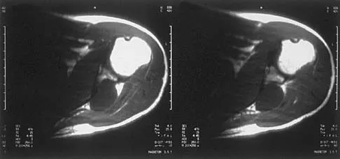 Basic Science Board Review 2000: High-Yield MCQs (Set 2) - Figure 18