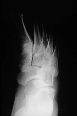 Basic Science Board Review 2000: High-Yield MCQs (Set 2) - Figure 22