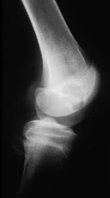 Basic Science Board Review 2000: High-Yield MCQs (Set 2) - Figure 29