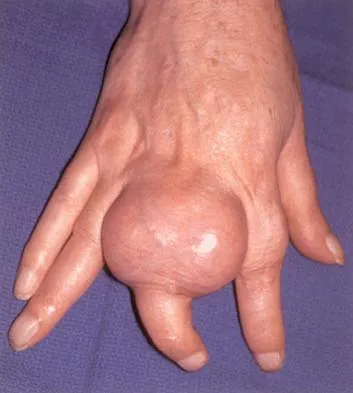 Basic Science Board Review 2000: High-Yield MCQs (Set 2) - Figure 31