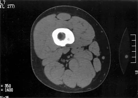 Basic Science Board Review 2000: High-Yield MCQs (Set 2) - Figure 36