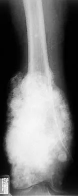 Basic Science Board Review 2000: High-Yield MCQs (Set 2) - Figure 42