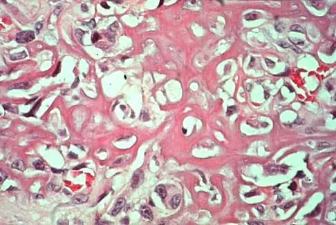 Basic Science Board Review 2000: High-Yield MCQs (Set 2) - Figure 45