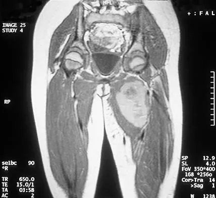 Basic Science Board Review 2000: High-Yield MCQs (Set 2) - Figure 49