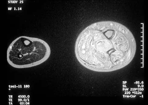 Basic Science 2000 Practice Questions: Set 3 (Solved) - Figure 11
