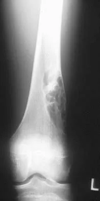 Basic Science 2000 Practice Questions: Set 3 (Solved) - Figure 18