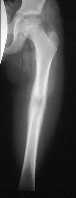 Basic Science 2000 Practice Questions: Set 3 (Solved) - Figure 20