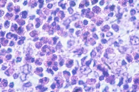 Basic Science 2000 Practice Questions: Set 3 (Solved) - Figure 23