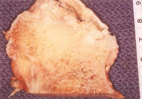 Basic Science 2000 Practice Questions: Set 3 (Solved) - Figure 25