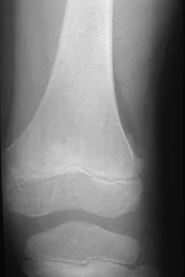 Basic Science Board Review 2000: High-Yield MCQs (Set 4) - Figure 11