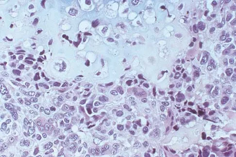 Basic Science Board Review 2000: High-Yield MCQs (Set 4) - Figure 15