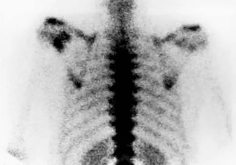 Basic Science Board Review 2000: High-Yield MCQs (Set 4) - Figure 25