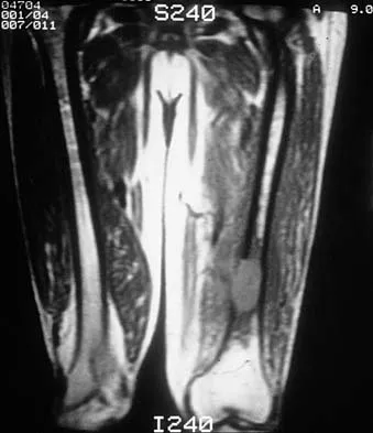 Basic Science Board Review 2000: High-Yield MCQs (Set 4) - Figure 32