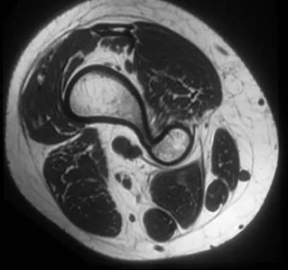 Basic Science Board Review 2000: High-Yield MCQs (Set 4) - Figure 34
