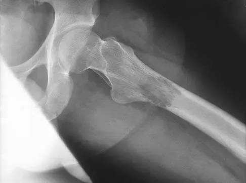 Basic Science 2002 Practice Questions: Set 1 (Solved) - Figure 13