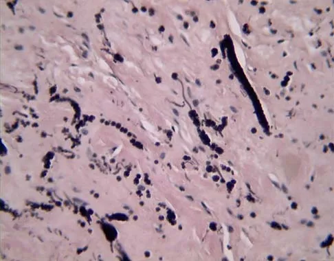 Basic Science 2002 Practice Questions: Set 1 (Solved) - Figure 15