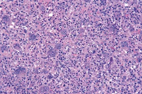 Basic Science 2002 Practice Questions: Set 1 (Solved) - Figure 17