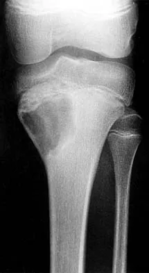Basic Science 2002 Practice Questions: Set 1 (Solved) - Figure 18