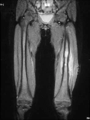 Basic Science 2002 Practice Questions: Set 1 (Solved) - Figure 2