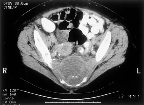 Basic Science 2002 Practice Questions: Set 1 (Solved) - Figure 23