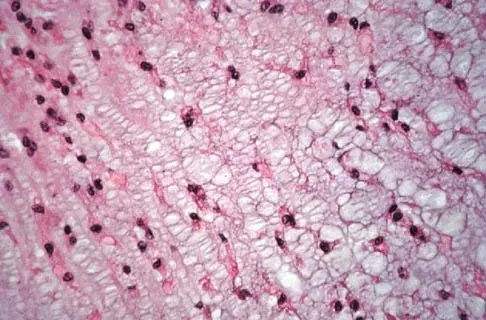 Basic Science 2002 Practice Questions: Set 1 (Solved) - Figure 25