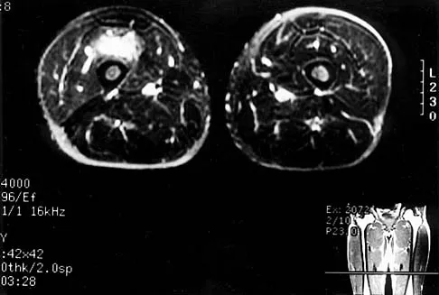Basic Science 2002 Practice Questions: Set 1 (Solved) - Figure 28