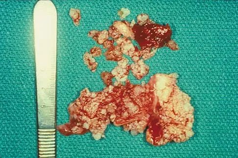 Basic Science 2002 Practice Questions: Set 1 (Solved) - Figure 32
