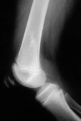 Basic Science 2002 Practice Questions: Set 1 (Solved) - Figure 40