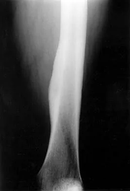 Basic Science 2002 Practice Questions: Set 1 (Solved) - Figure 42