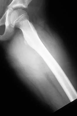 Basic Science 2002 Practice Questions: Set 1 (Solved) - Figure 47