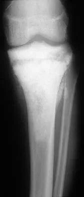 Basic Science Board Review 2002: High-Yield MCQs (Set 2) - Figure 26