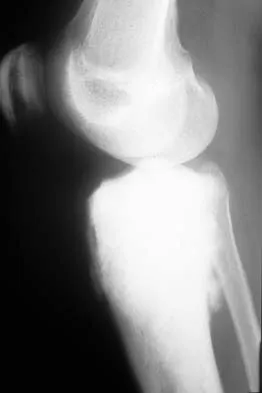 Basic Science Board Review 2002: High-Yield MCQs (Set 2) - Figure 27