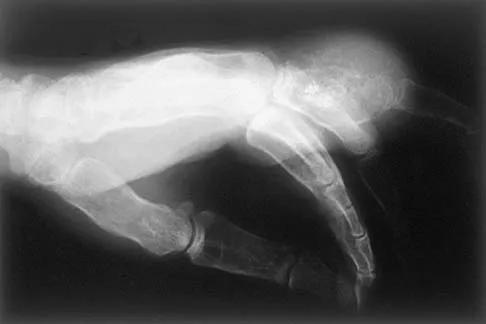 Basic Science Board Review 2002: High-Yield MCQs (Set 2) - Figure 32