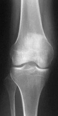 Basic Science Board Review 2002: High-Yield MCQs (Set 2) - Figure 37